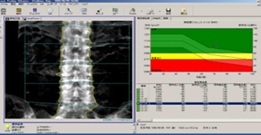 骨密度測定結果